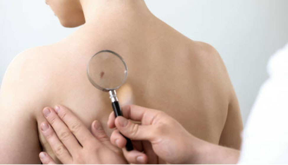 Skin Procedures