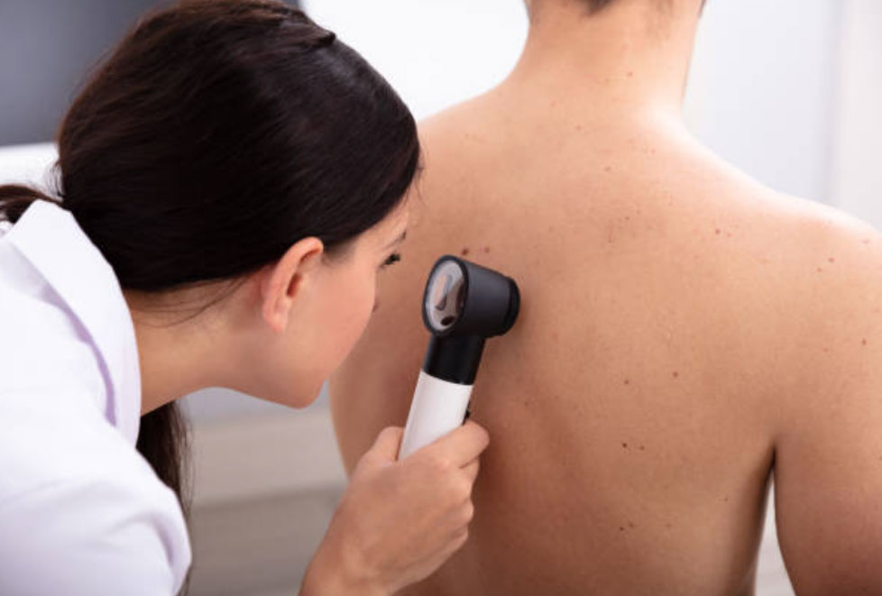 Skin Procedures